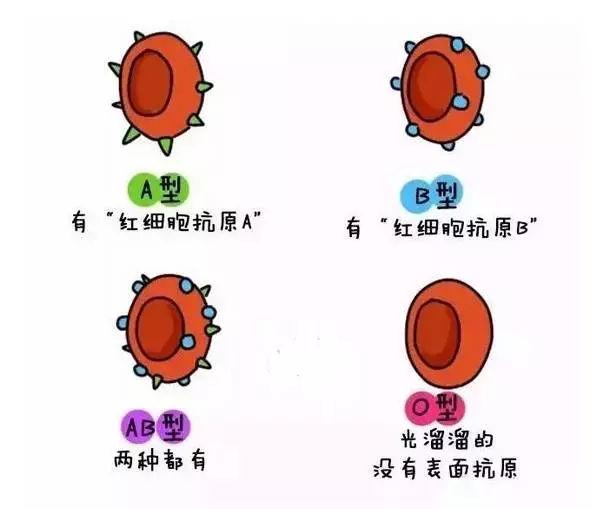 ABO溶血及时治疗宝宝预后良好