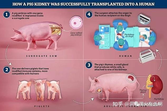 全球第3例基因编辑猪肾移植成功完成