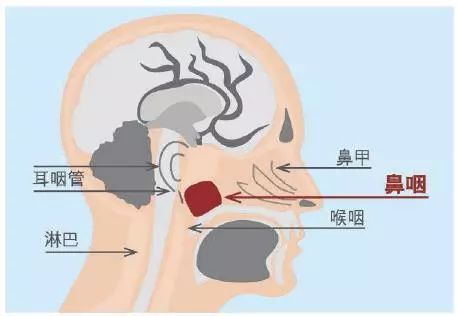 南方人易患鼻咽癌，揭秘背后的原因